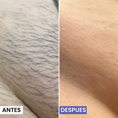 Lunéa Aceite de Cyperus Rotundus® - Vello más fino y menos visible