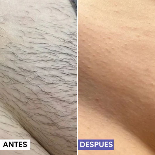 Lunéa Aceite de Cyperus Rotundus® - Vello más fino y menos visible