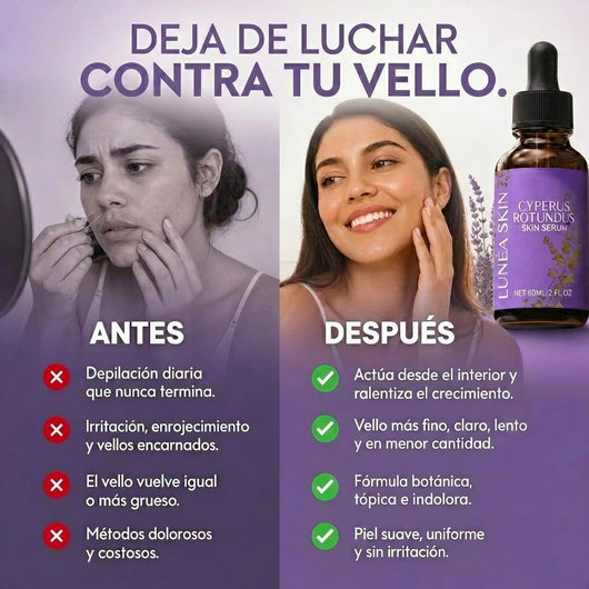 Serum Lunéa® | Frena y Debilita Tu Vello Facial Naturalmente
