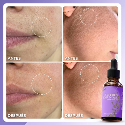 Serum Lunéa® | Frena y Debilita Tu Vello Facial Naturalmente