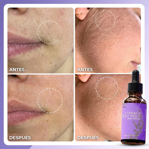 Serum Lunéa® | Frena y Debilita Tu Vello Facial Naturalmente