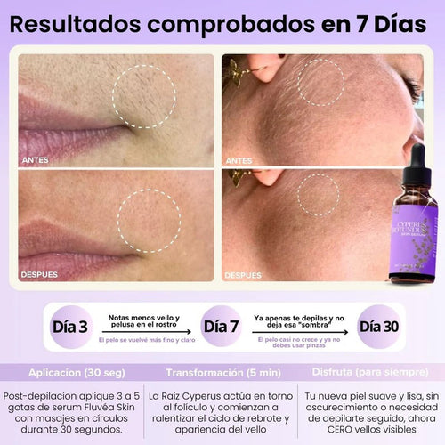 Lunéa - Vello más fino y menos visible con Raiz de Cyperus Rotundus
