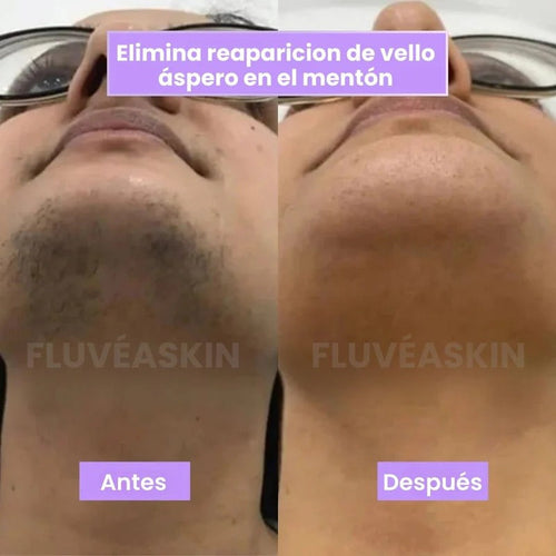 Lunéa - Vello más fino y menos visible con Raiz de Cyperus Rotundus