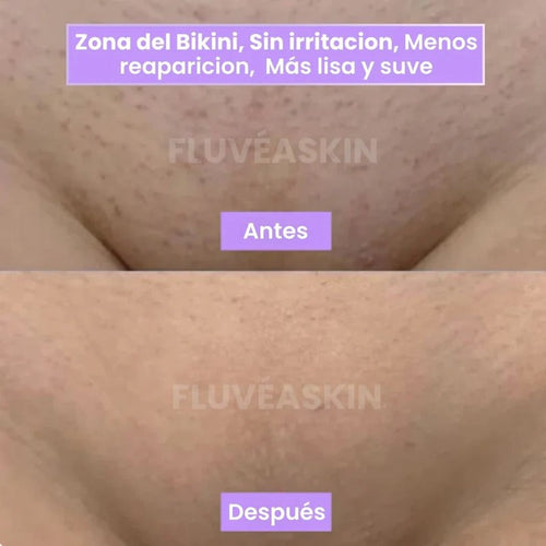 Lunéa - Vello más fino y menos visible con Raiz de Cyperus Rotundus