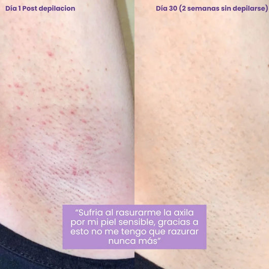 Serum Lunéa® | Frena y Debilita Tu Vello Facial Naturalmente