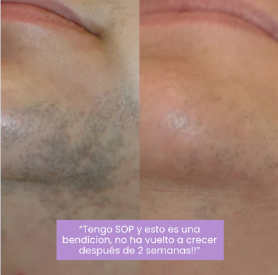 Serum Lunéa® | Frena y Debilita Tu Vello Facial Naturalmente