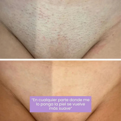Serum Lunéa® | Frena y Debilita Tu Vello Facial Naturalmente